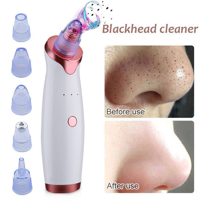 Electric Suction Blackhead Remover